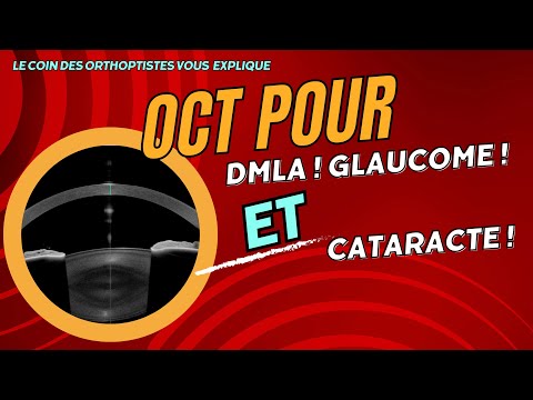 Pourquoi faire un OCT ?  pour le Glaucome, la DMLA, la Cataracte (Ophtalmologie /Orthoptie)