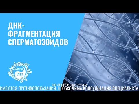 ДНК-фрагментация сперматозоидов | мужское бесплодие