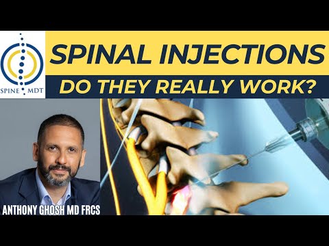 Spinal Injections Explained – Do They Really Work?