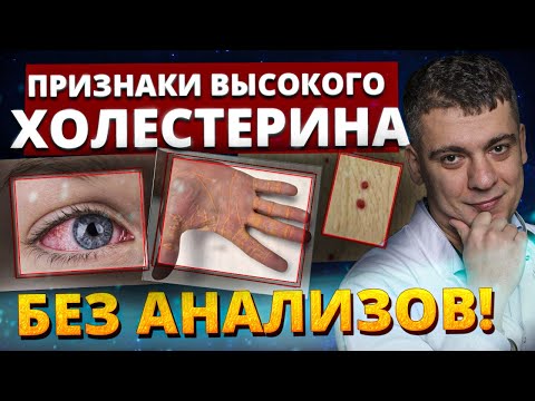 HIGH CHOLESTEROL! 5 ALARMING SIGNS. IDENTIFY IT AT HOME, EVEN WITHOUT A DOCTOR!