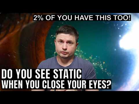 I Found Out I Have a Weird Brain Condition That Makes Everything Look Static