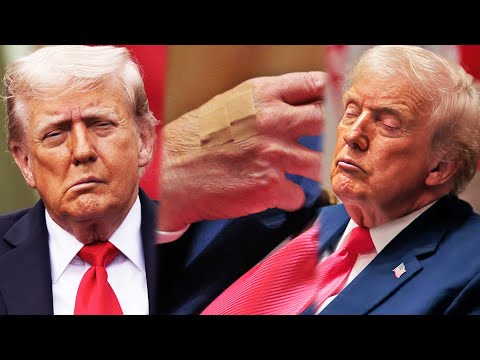 Trump FURIOUS about his cognitive decline