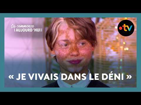 Choc émotionnel : Chloé a développé une hyperpigmentation puis un vitiligo - Ça commence aujourd'hui