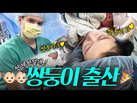 드디어 만난 둥이들👶🏻👶🏻(이름공개✨),미국에서 쌍둥이 출산 후기.