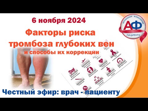 Факторы риска тромбоза глубоких вен: как их устранить?