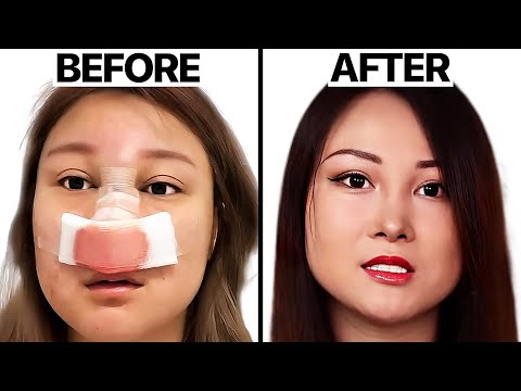 I Got Plastic Surgery And I Regret It | Surgeon Reacts