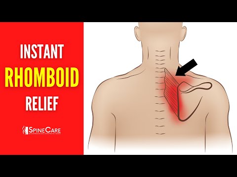 How to INSTANTLY Relieve Rhomboid Pain