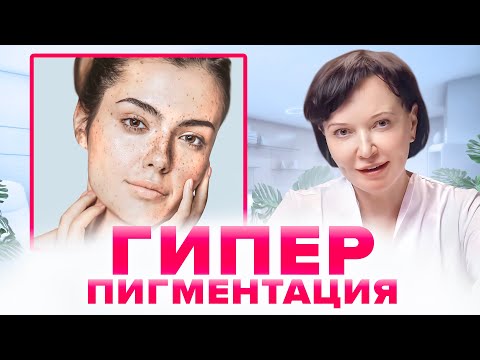Гиперпигментация. Как избавиться от пигментных пятен | Ирина Рахова