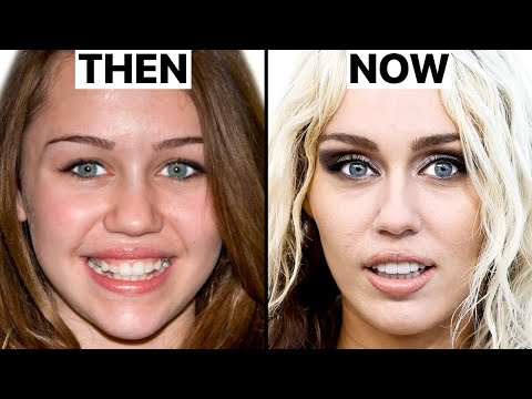 What Happened to Miley Cyrus' Face? | Plastic Surgery Analysis