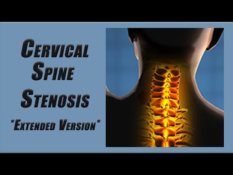 Best Exercises for Stenosis in the Cervical Spine | Slower Pace and More Reps