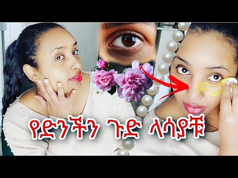 በድንች የሚሰራ የቆዳ መድኃኒት❗️በአጭር ጊዜ የጠቆረ ቆዳን ለማንጣት ❗️ለጠቆረ አይን እና ማድያት❗️