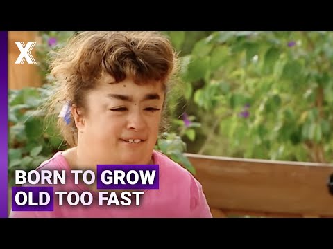 The Aging Disease That Defies Science