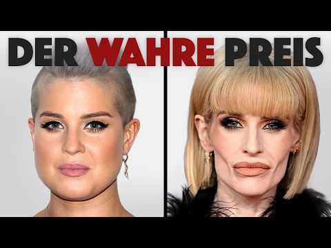 Schlaffe Gesichter & Sammelklagen: Die bittere biologische Quittung von Ozempic & co.