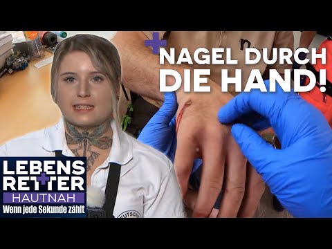 Schmerzhafter Arbeitsunfall & großes Glück im Unglück | Lebensretter hautnah | SAT.1