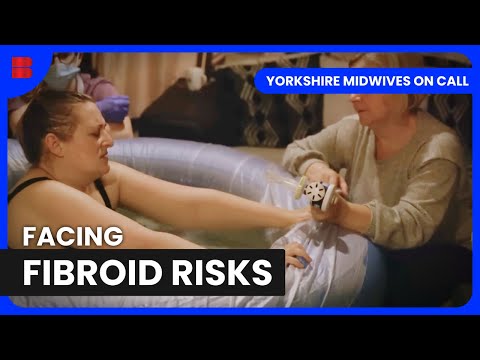 Fibroid Complications and Home Birth | Yorkshire Midwives On Call