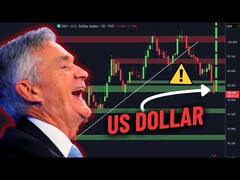 The US Dollar is about to Change Everything.