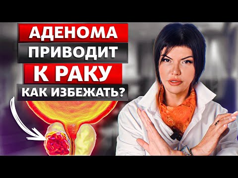 Аденома простаты. Лечение БЕЗ операции ВОЗМОЖНО! Уролог.