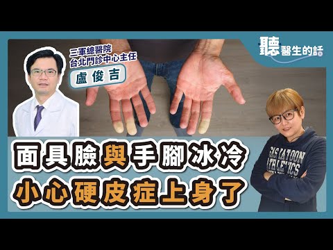 '25.03.10【愛健康│聽醫生的話】盧俊吉醫師談「面具臉與手腳冰冷 小心硬皮症上身了」