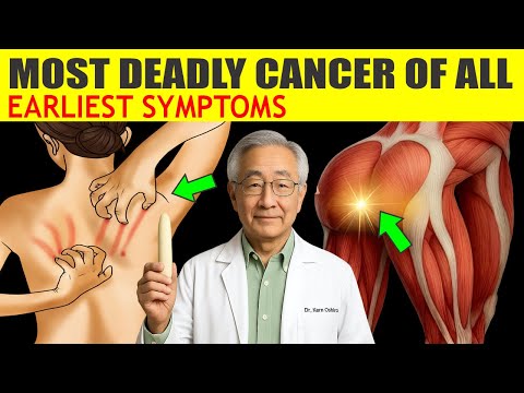 PANCREATIC CANCER: 8 Early Symptoms You Should Never Ignore