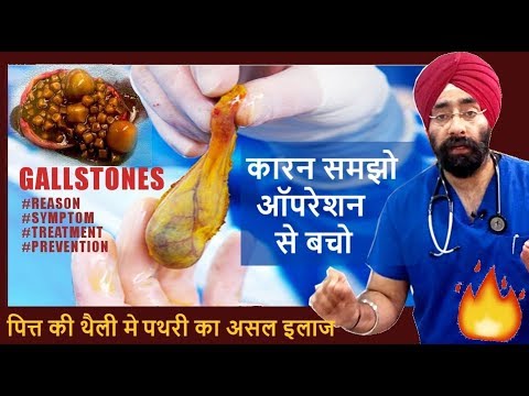 Rx GALLSTONE #1 (Hindi) पित्त की थैली मे पथरी का कारन समझो ऑपरेशन से बचो (ENG SUBTITLES)