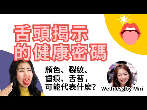 舌頭揭示健康密碼：從顏色、裂紋、齒痕到舌苔，身體在對你說什麼？