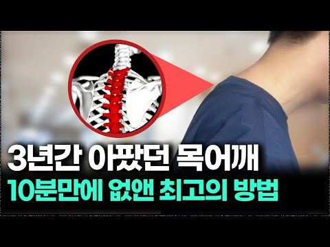 목 아픈 사람 99%가 모르는 비밀 “여기를” 펴내면 거북목 일자목 통증 기적처럼 좋아집니다!