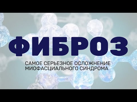 Muscle Fibrosis. Myofascial Syndrome Research. How Trigger Points and Fibrosis Occur