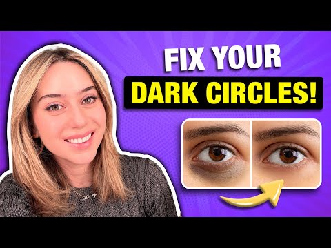 Dark Circles: REAL Solutions That Work! | Dr. Shereene Idriss