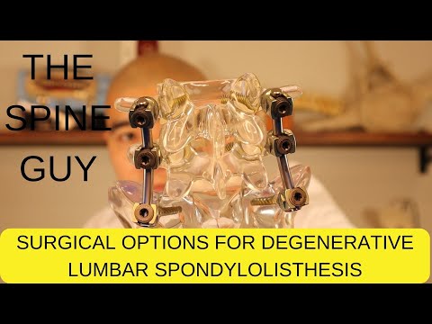 Surgical Treatment Options for Degenerative Lumbar Spondylolisthesis - Part 3