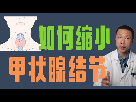 How to Shrink Thyroid Nodules (Benign Nodules)