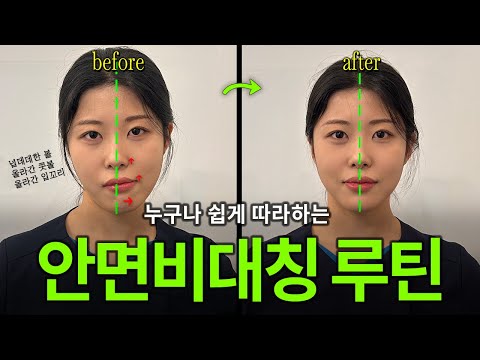 물리치료사가 알려주는 수술없이 하는 안면비대칭 교정 / 타입 진단 [안면비대칭 해결법] [안면비대칭 수술] [안면비대칭 자가진단] [안면비대칭 운동]