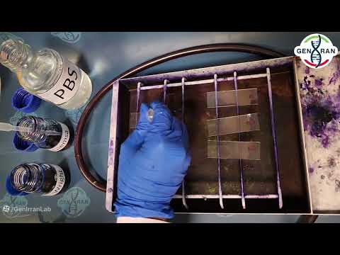 آموزش تهیه لام خون محیطی