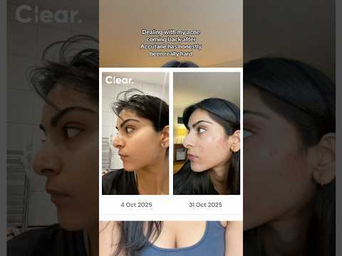 Thank you to everyone supporting me here and on Clear on my skincare journey ❤️‍🩹 #skincare #acne