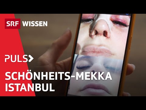 Operation Ausland: Unters Messer in die Türkei | Puls | SRF Wissen