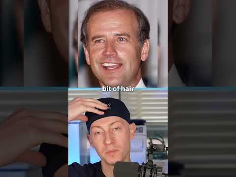 Has Joe Biden Had Plastic Surgery? | Plastic Surgery Analysis