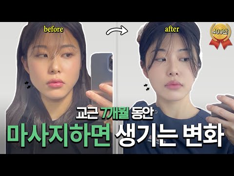 7 Months Later, the Reason Why My Face Looks Different