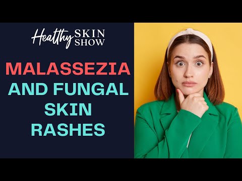 Malassezia And FUNGAL Skin Problems | Dr. Julie Greenberg
