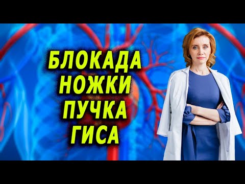 Bundle branch block. Cardiologist. Anna Korenevich