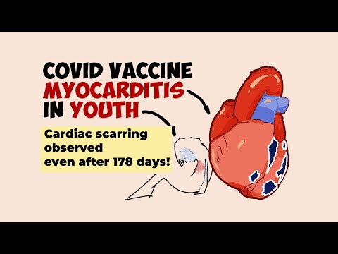 COVID Vaccine Myocarditis in Youth: How Serious Is It? (New Study Results)