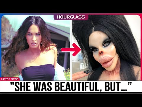 35 Shocking Celebrity Plastic Surgery Disasters | Then and Now 2025