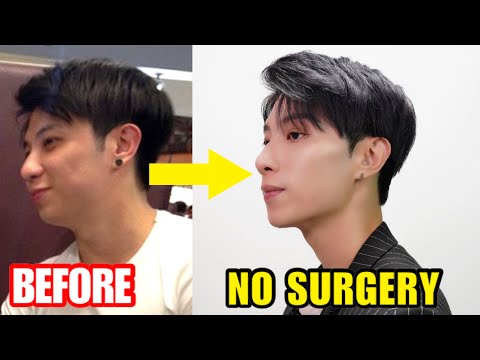 V shaped + JAWLINE NO Surgery No Money | 天然不花錢去除雙下巴 | ISSAC YIU