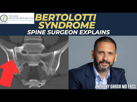 Bertolotti syndrome: Causes and treatment explained by a spine surgeon