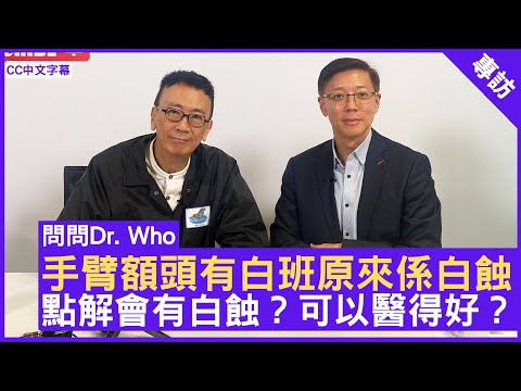 手臂額頭有白班原來係白蝕 點解會有白蝕？可以醫得好？可以點做？皮膚科專科 #馮偉傑醫生 鄭丹瑞《健康旦》(CC中文字幕)
