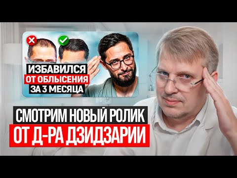 Watch Dr. Dzidzaria's new video on hair loss.