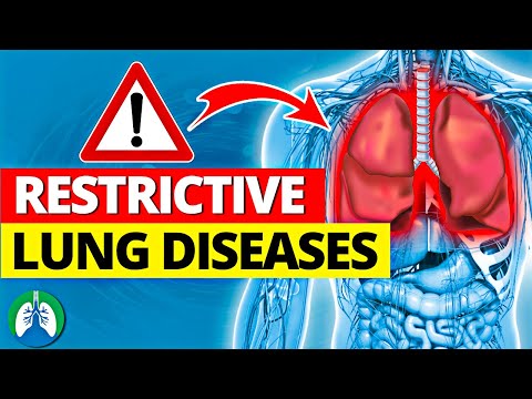 Top 13 Restrictive Lung Diseases to Know | Listed and Explained