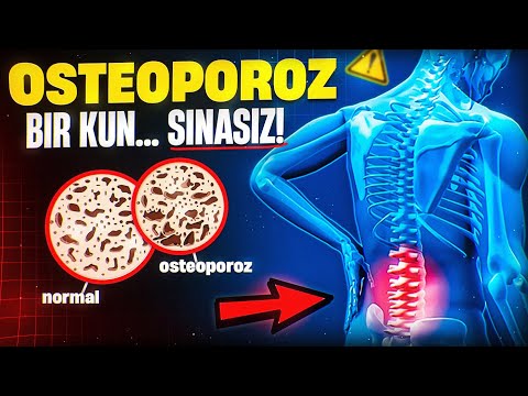 Остеопороз – Бир кун... синасиз! | Доктор Гулбаҳор
