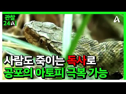[#관찰24시] 아토피를 호전시킨 특효 약의 정체✨ 사람도 죽이는 뱀🐍의 독으로 만들었다😲? | #관찰카메라24시간 160회