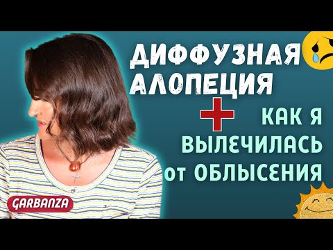 Диффузная алопеция. Лечение выпадения волос