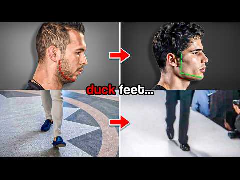 The Way You Walk Is Making You Ugly