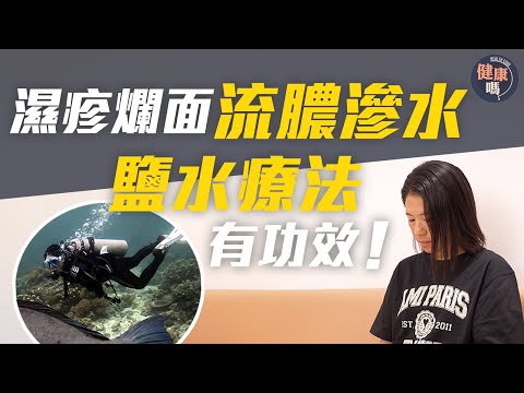 濕疹爛面流膿 中醫成功消炎穩定皮膚｜類固醇藥膏無益 削弱抗炎能力易復發｜1樣戶外活動對濕疹有幫助｜健康嗎@HealthCodeHK 【醫檔案】#濕疹 #中醫